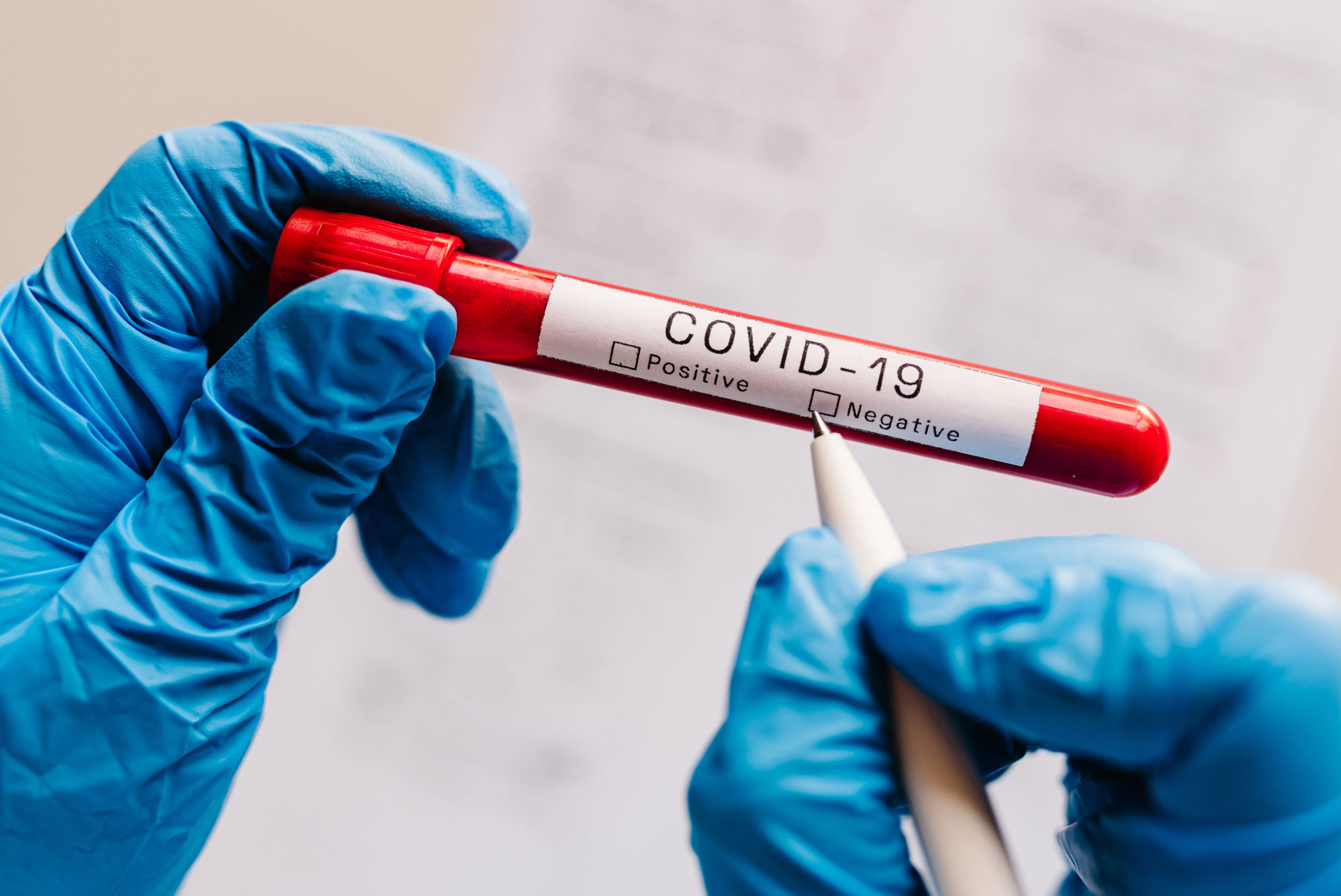 Covid-19 blood test being marked negative